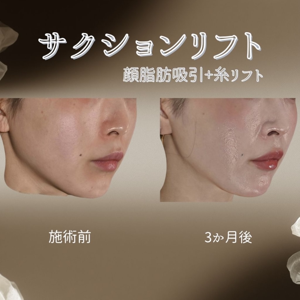 症例のビフォー画像