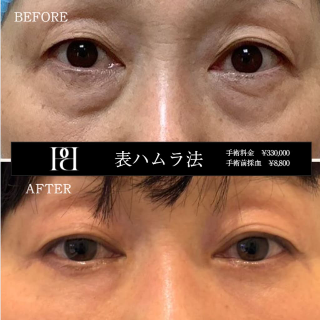 症例のビフォー画像
