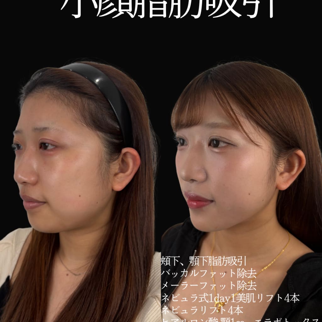 症例のビフォー画像