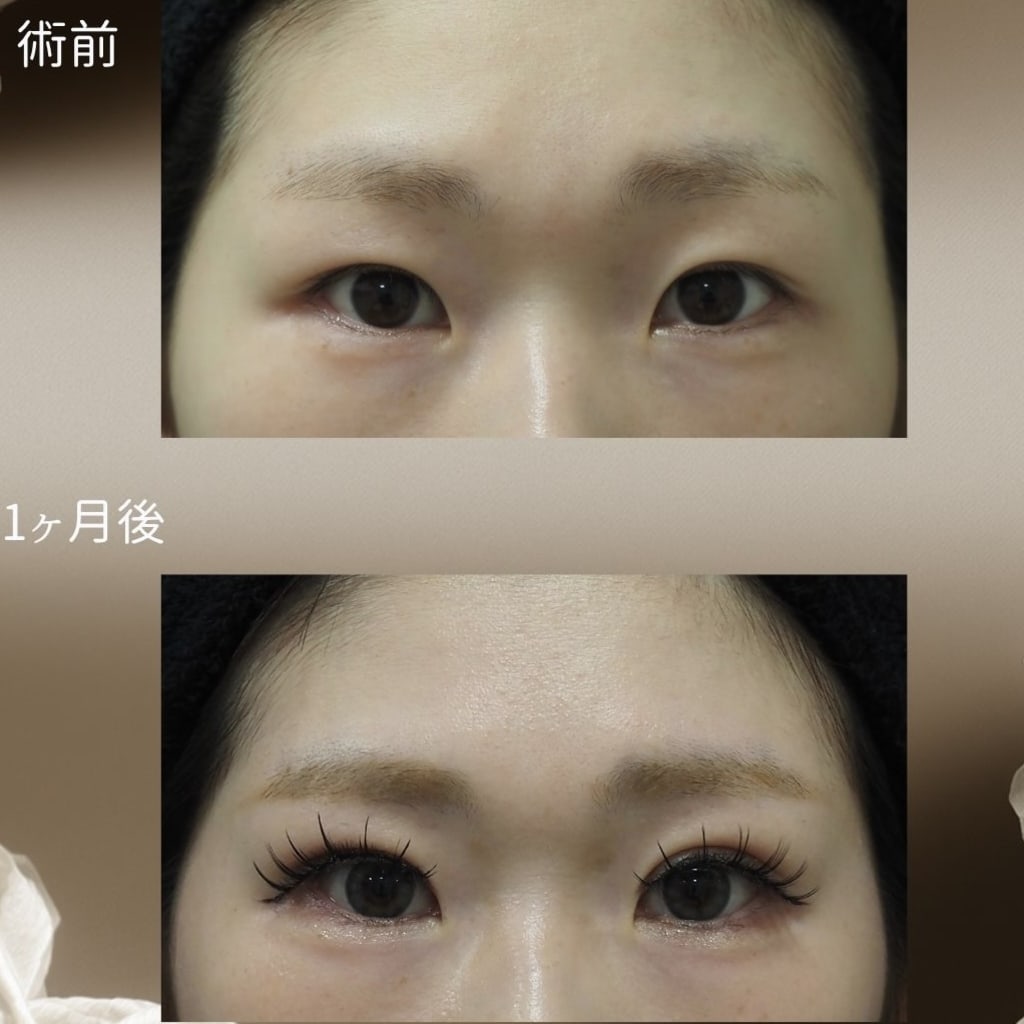 症例のビフォー画像