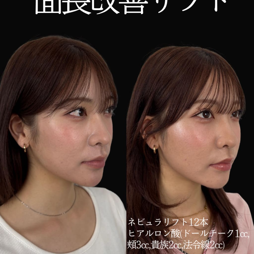 症例のビフォー画像