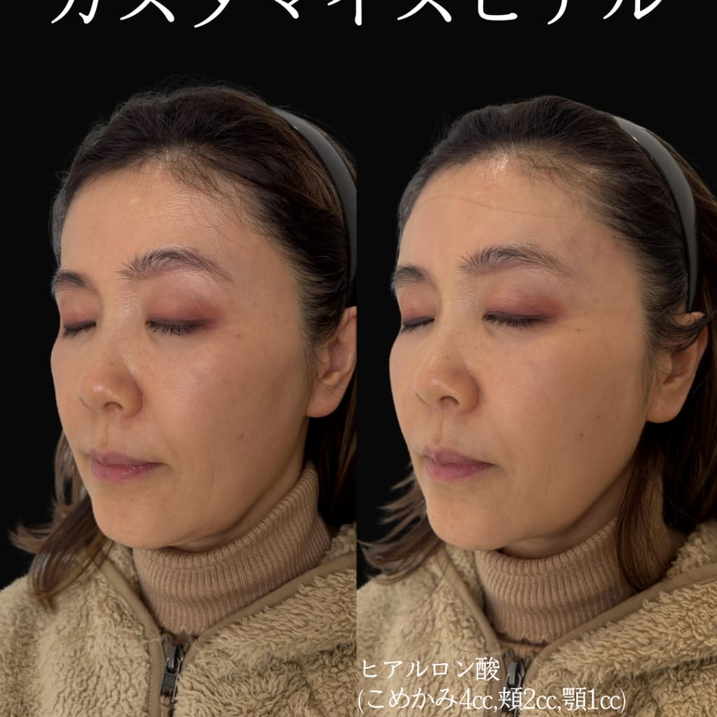 症例のビフォー画像