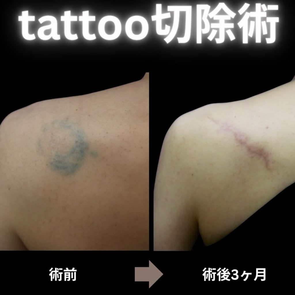 症例のビフォー画像