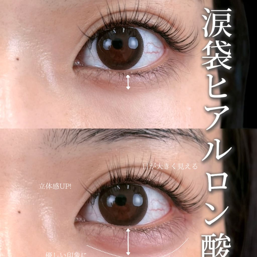 症例のビフォー画像