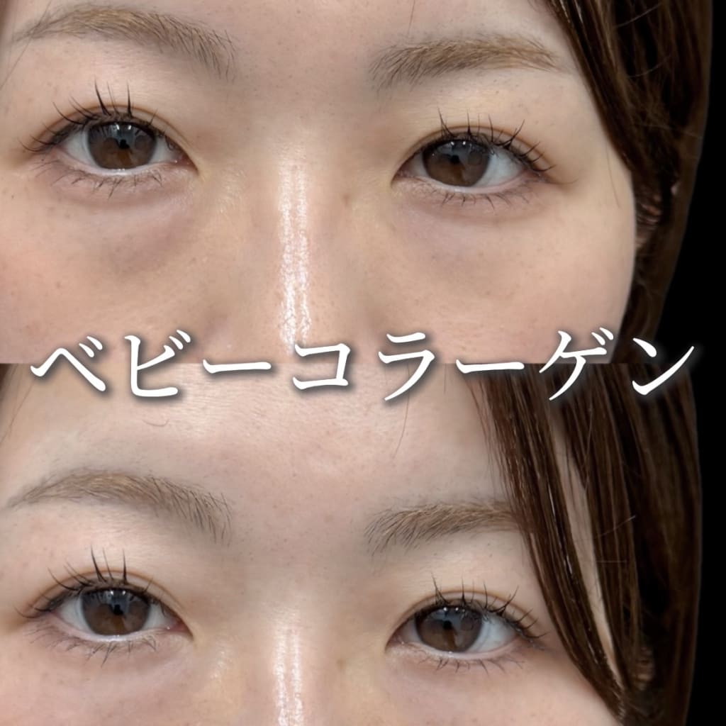 症例のビフォー画像