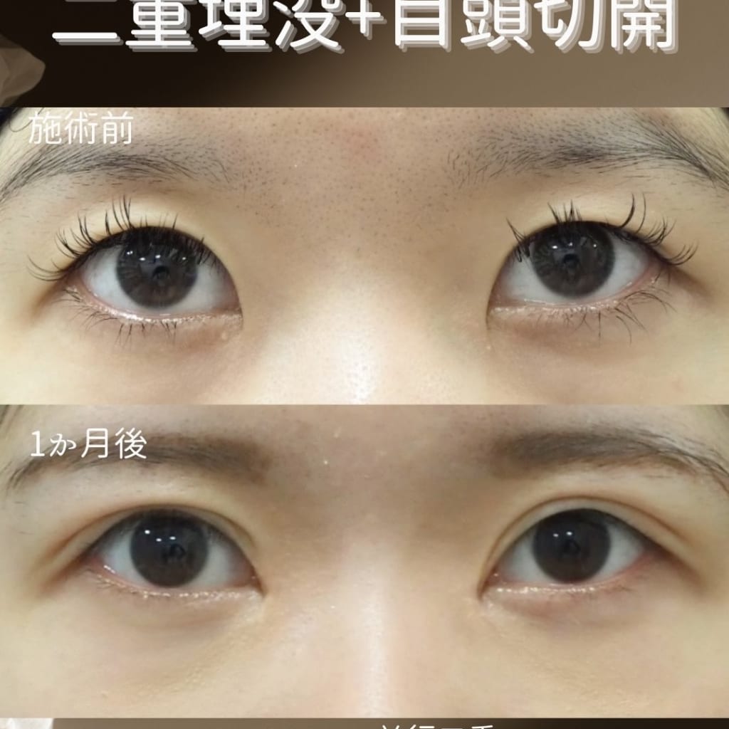 症例のビフォー画像