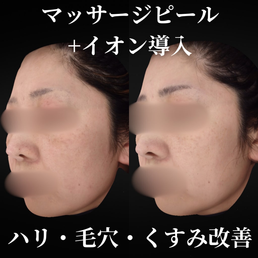 症例のビフォー画像