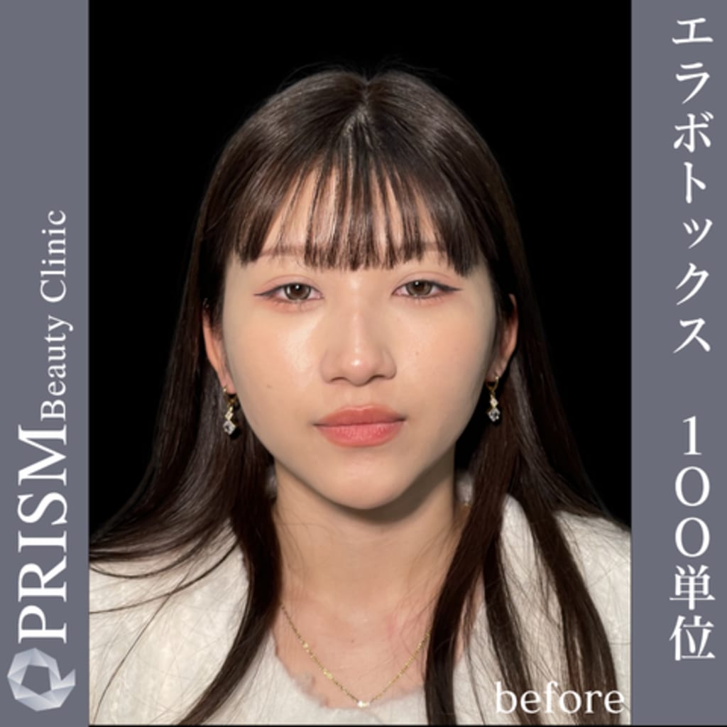 症例のビフォー画像
