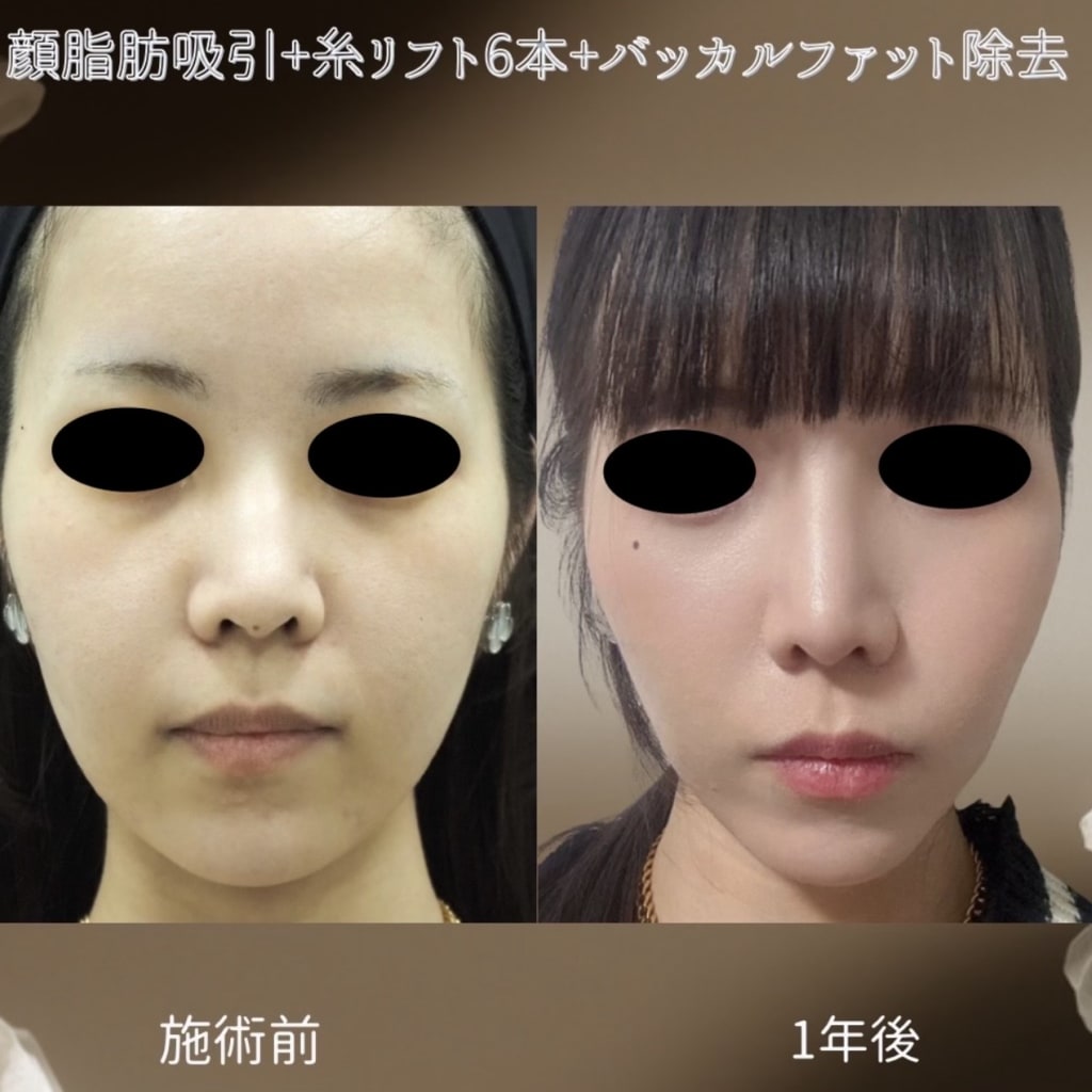 症例のビフォー画像