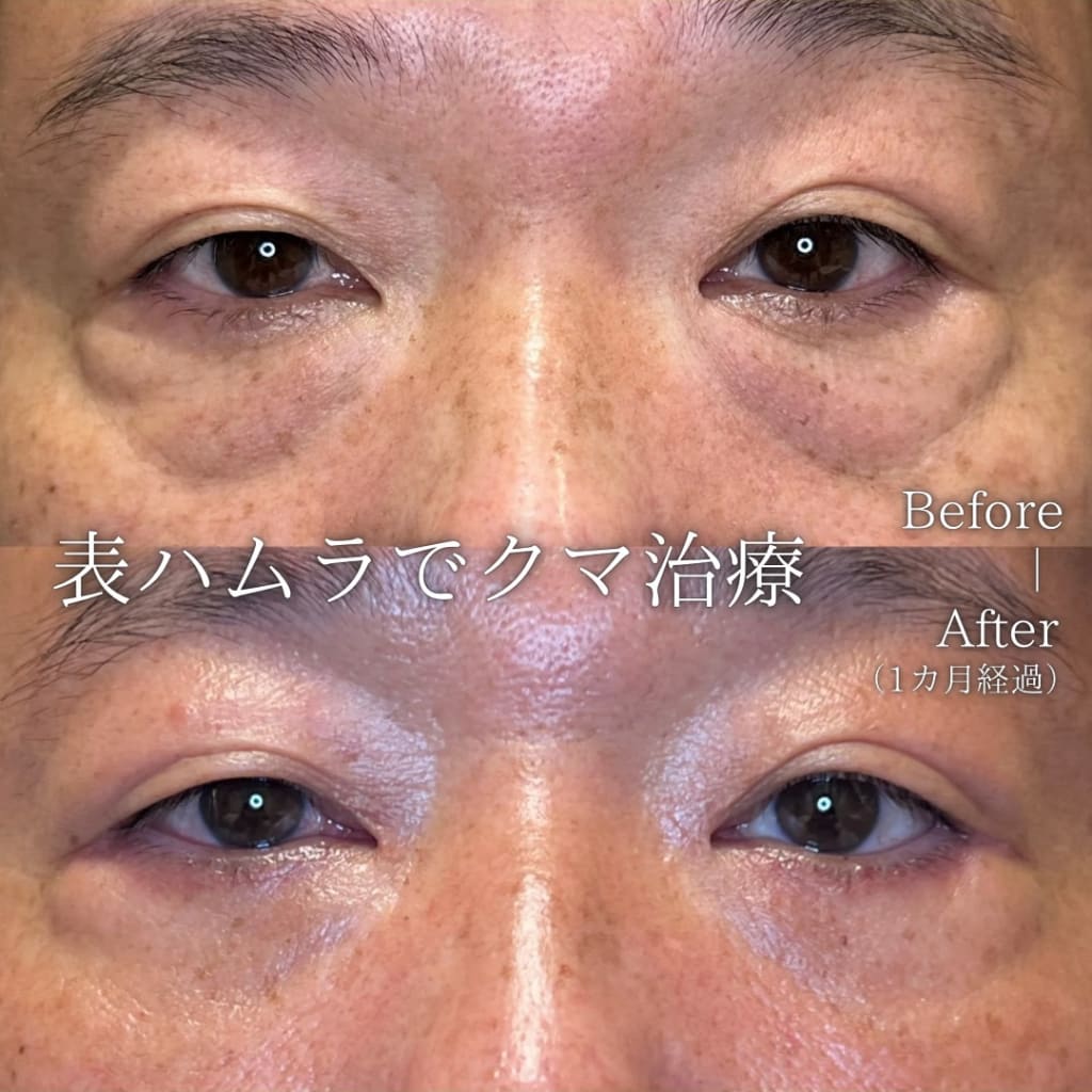 症例のビフォー画像