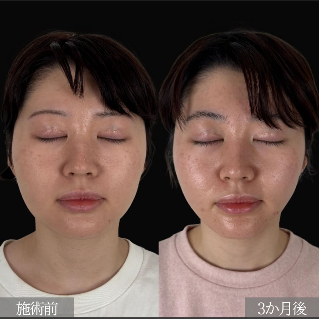 症例のビフォー画像