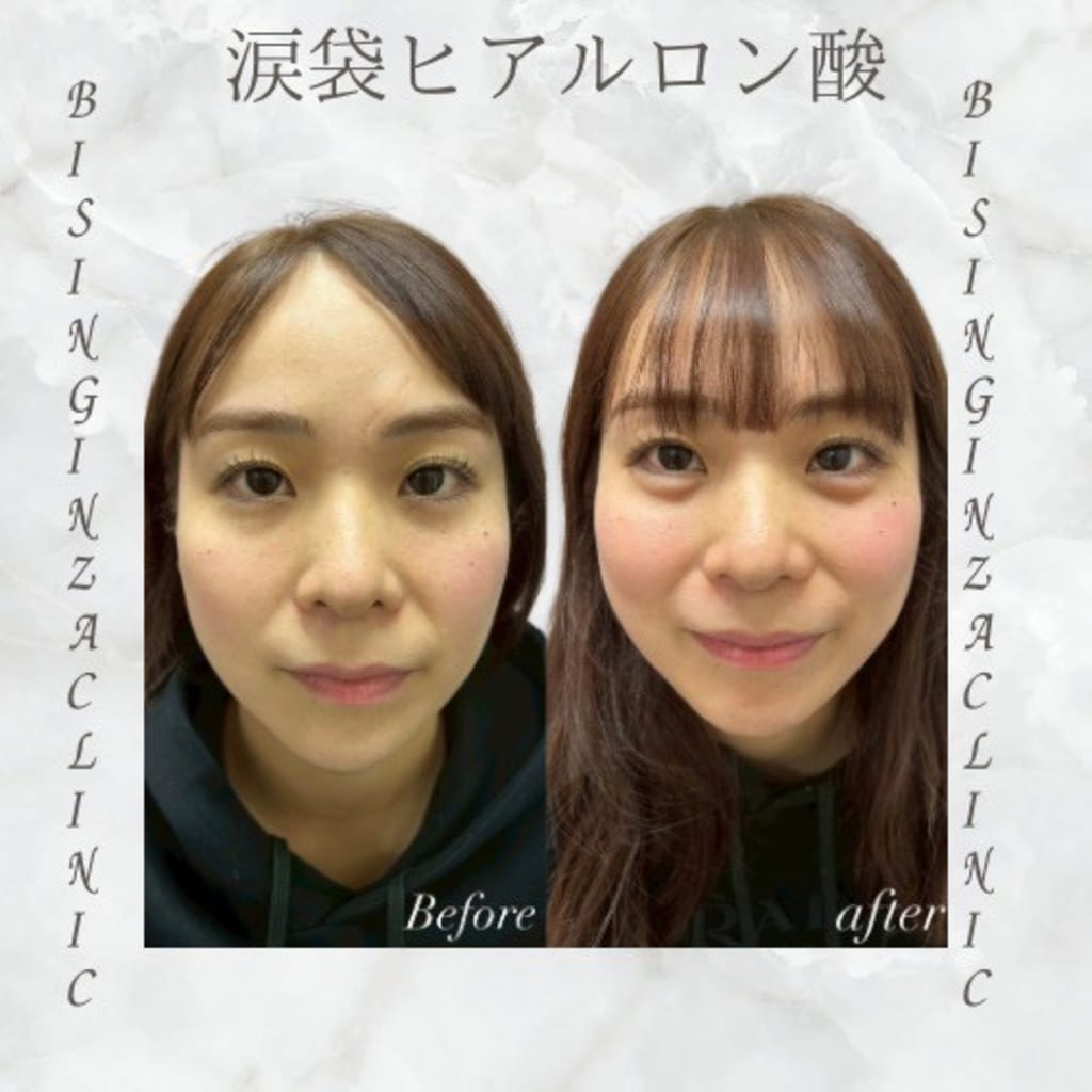 症例のビフォー画像