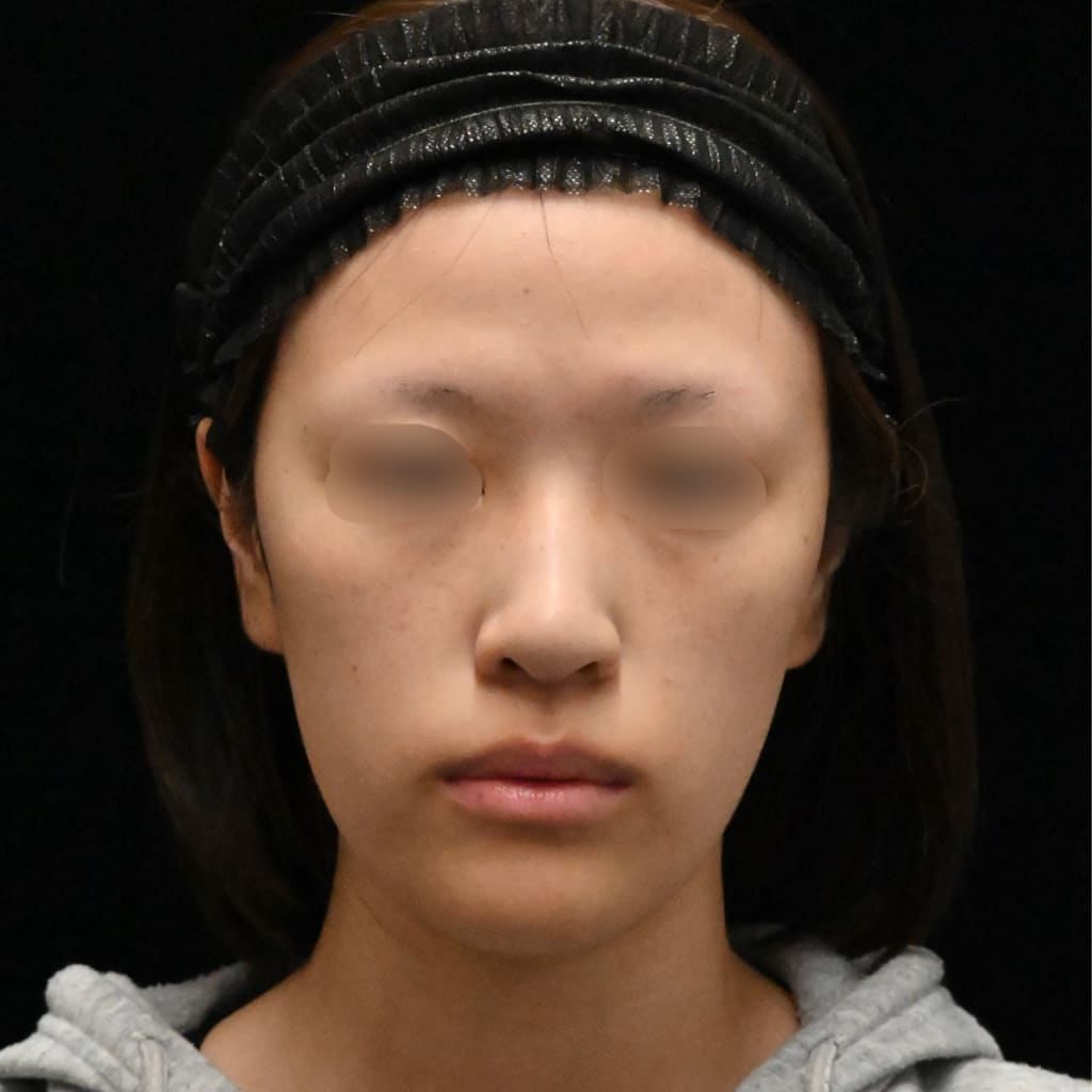 症例のビフォー画像