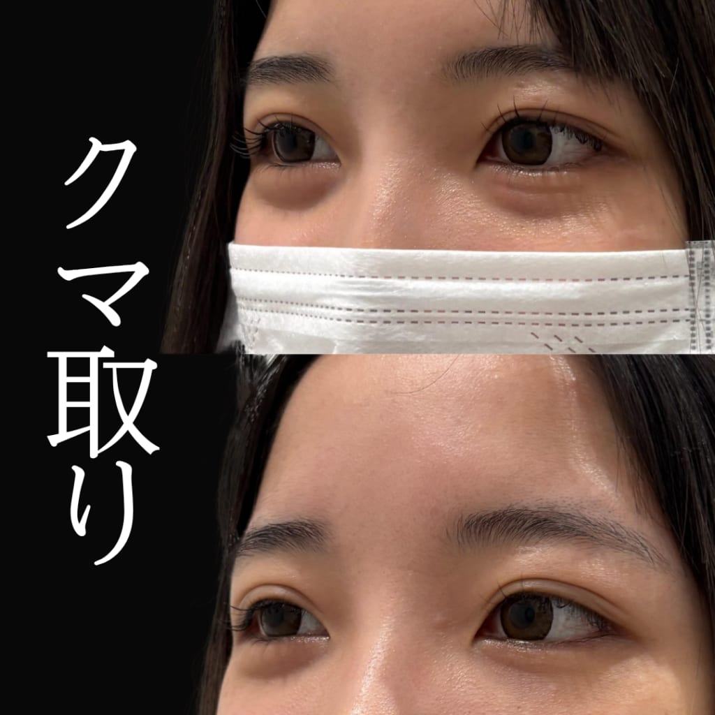 症例のビフォー画像