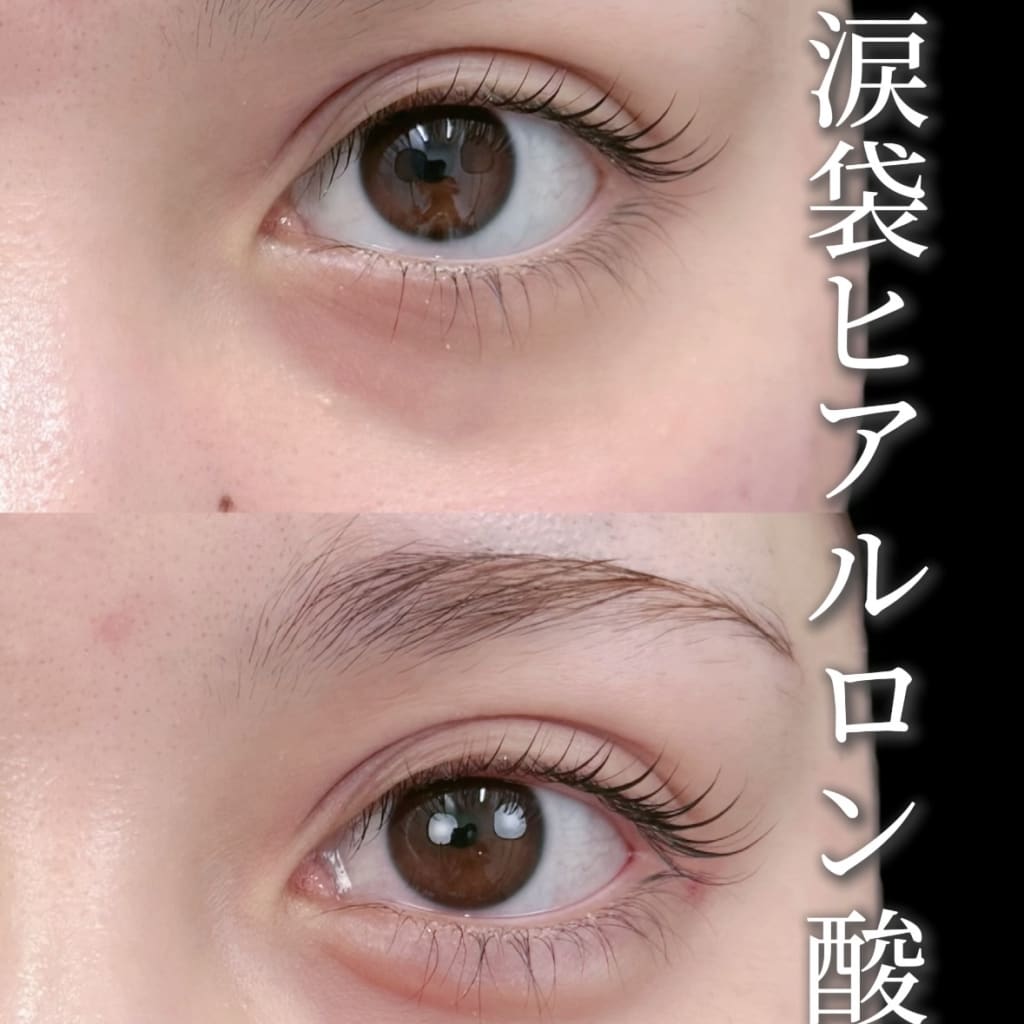 症例のビフォー画像