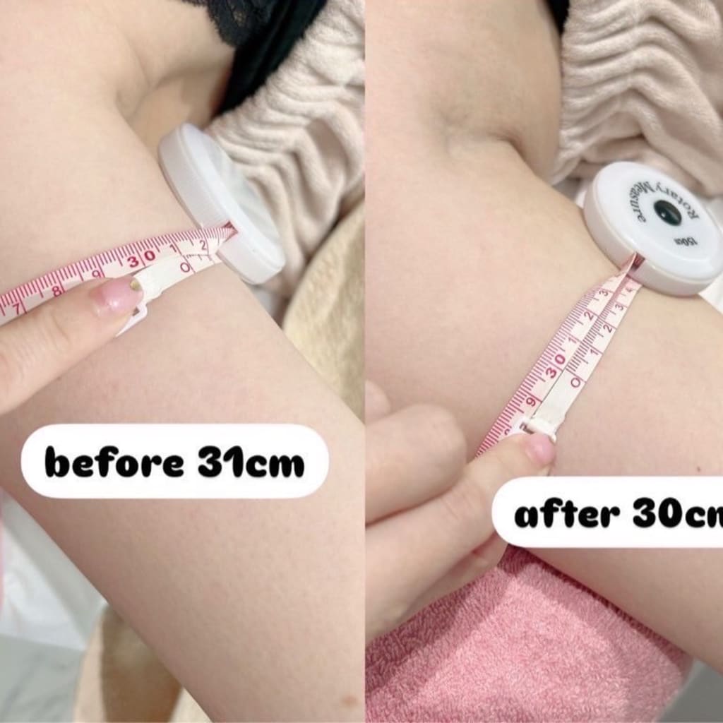 症例のビフォー画像