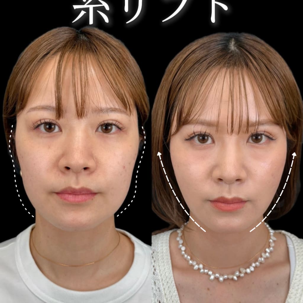 症例のビフォー画像