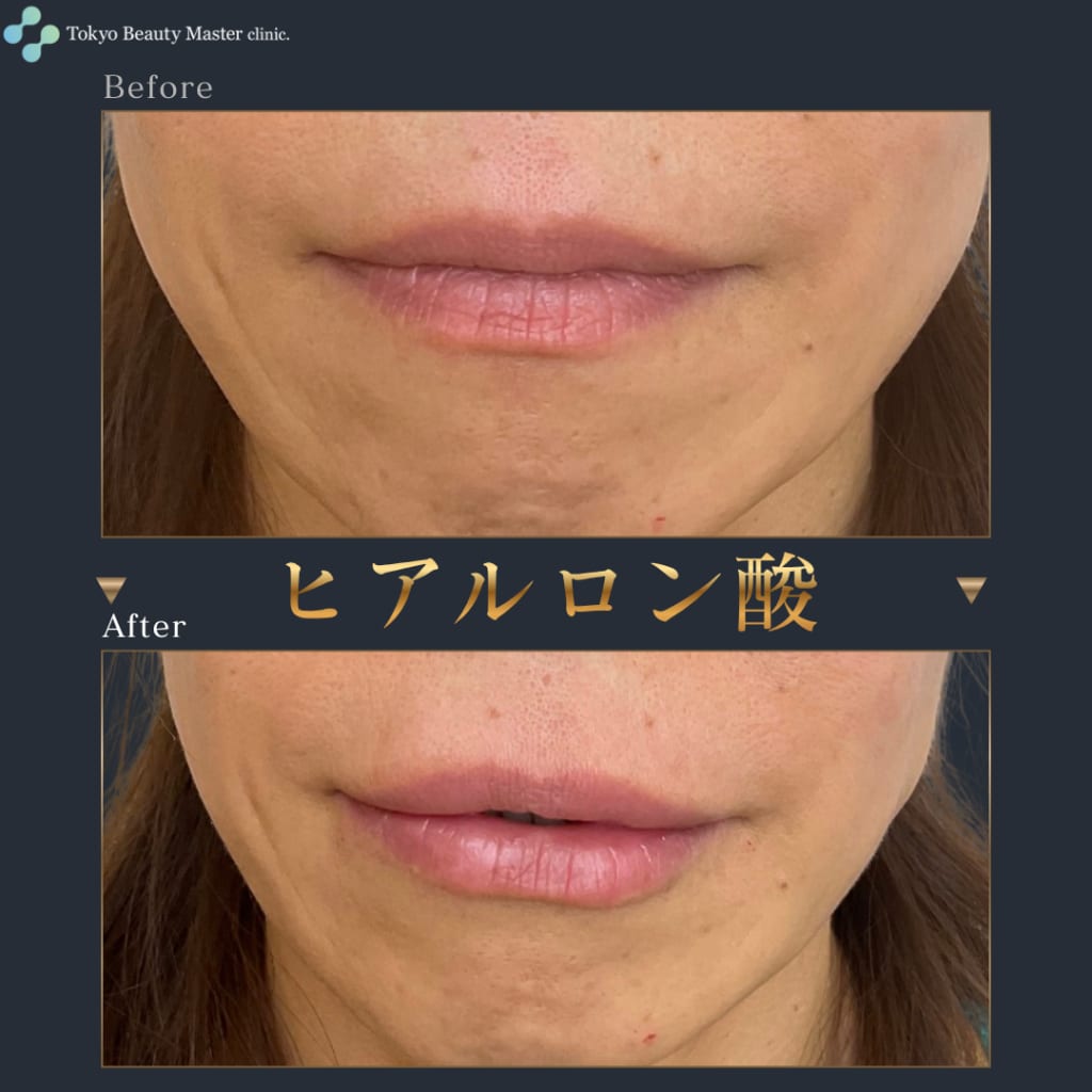 症例のビフォー画像
