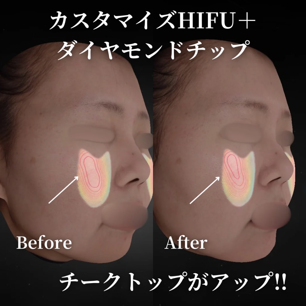 症例のビフォー画像