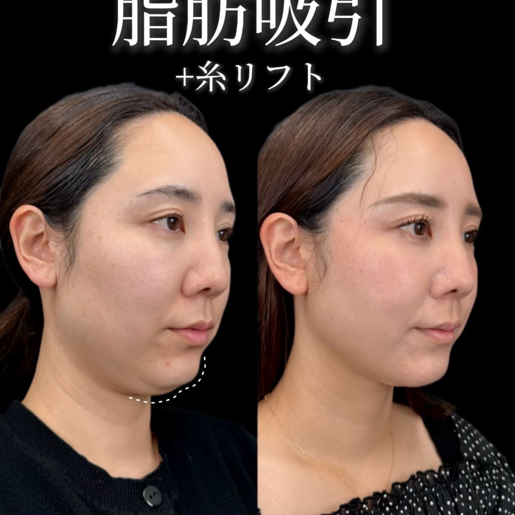 症例のビフォー画像