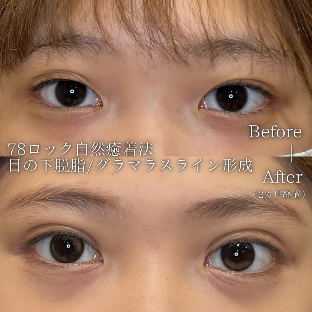 症例のビフォー画像