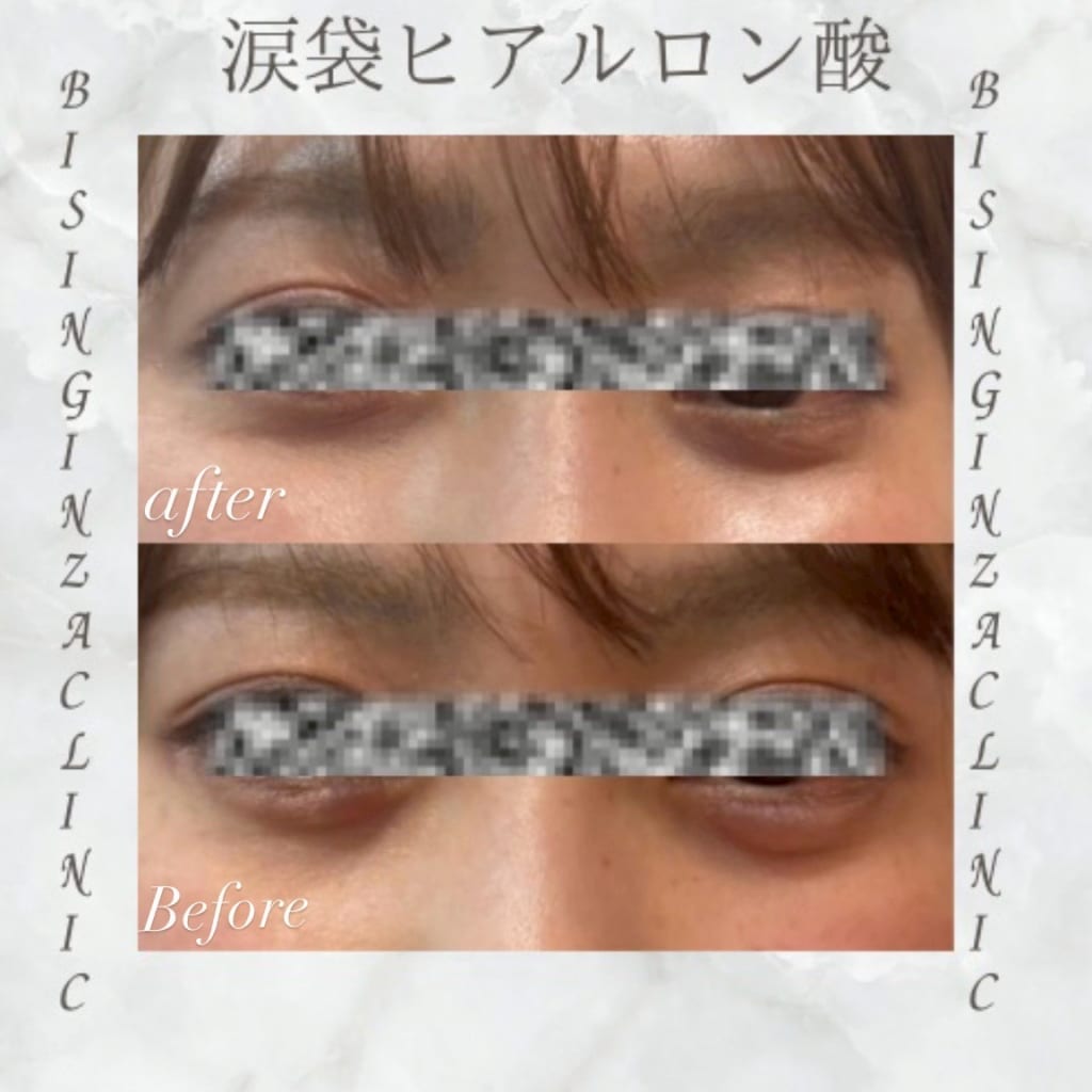症例のビフォー画像
