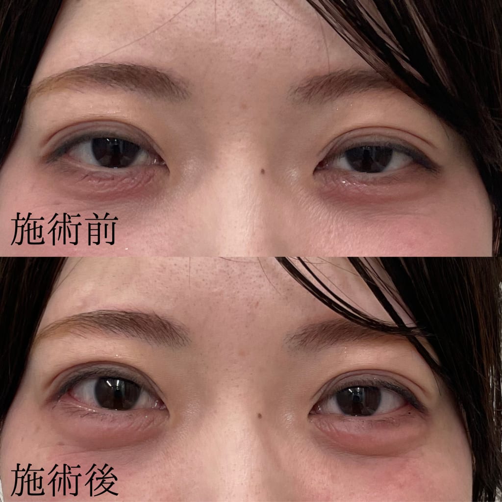 症例のビフォー画像