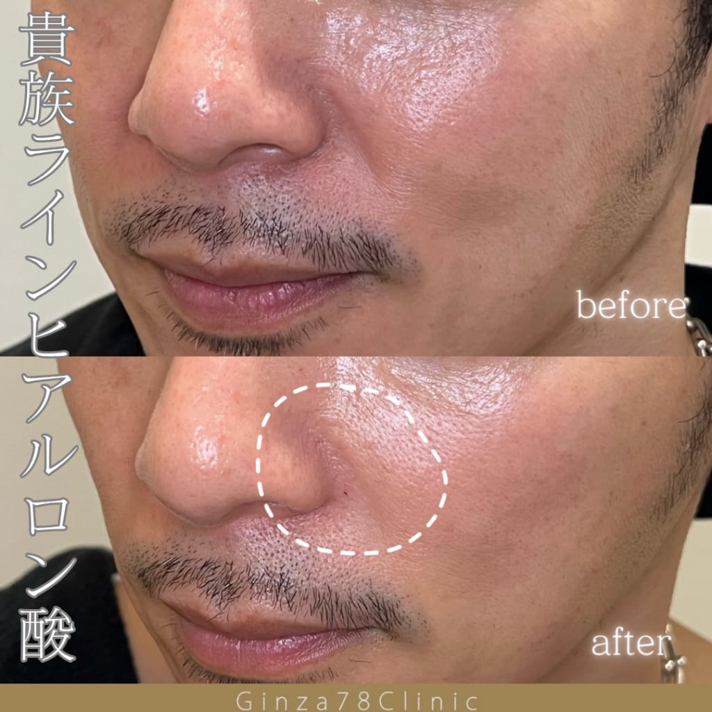 症例のビフォー画像