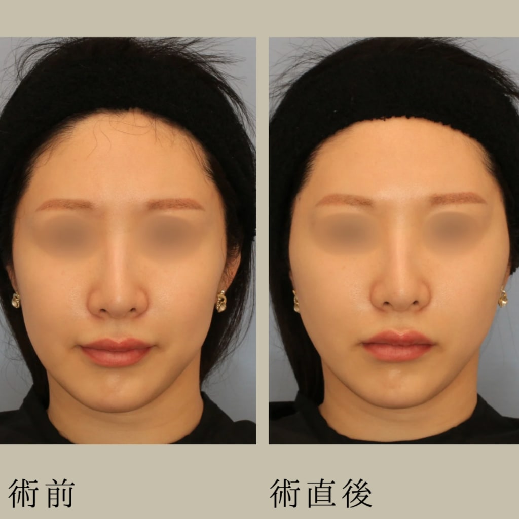症例のビフォー画像