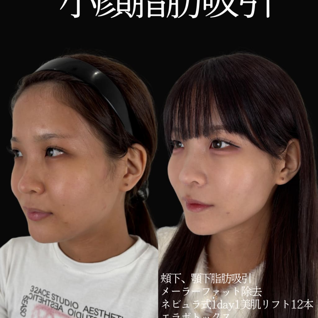 症例のビフォー画像