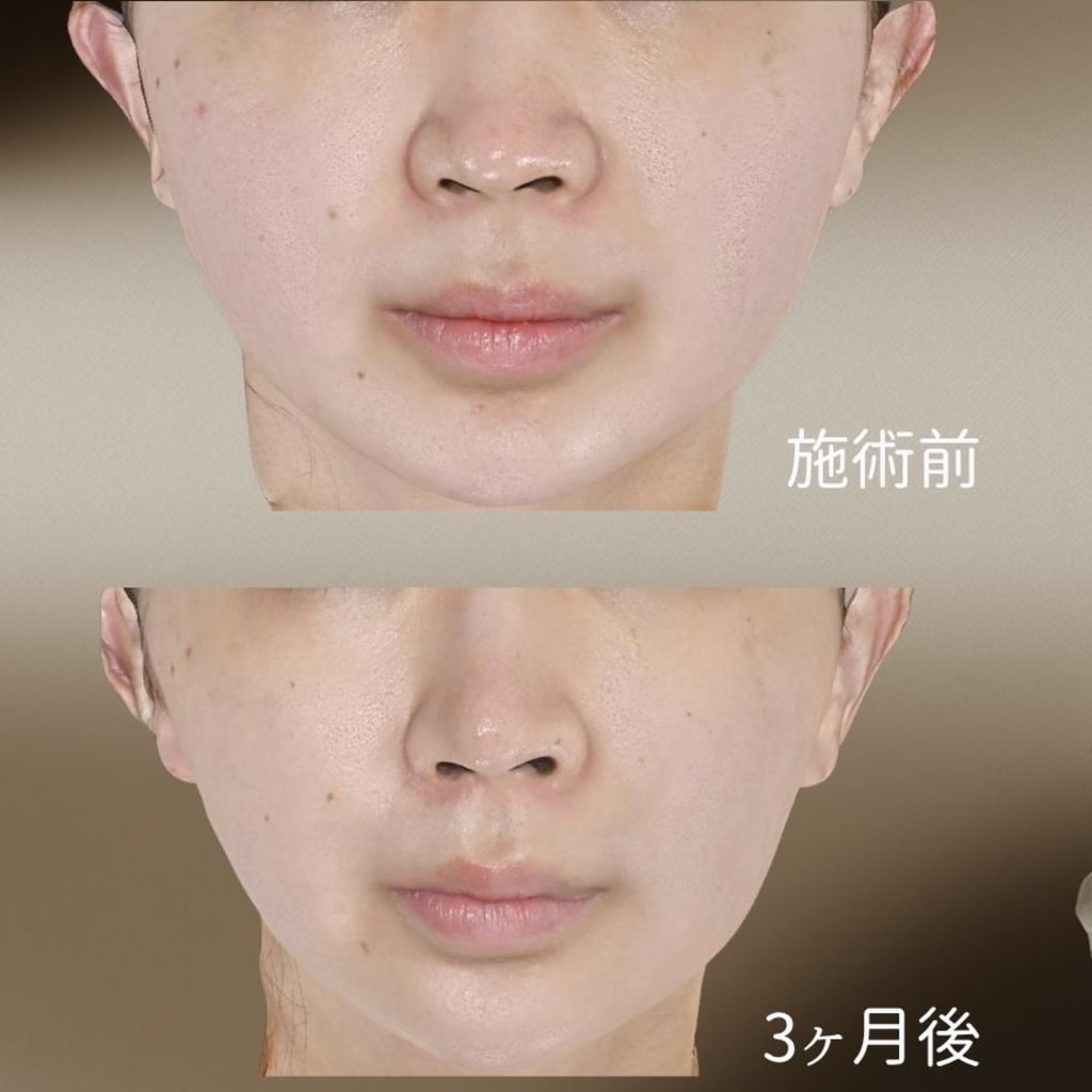 症例のビフォー画像