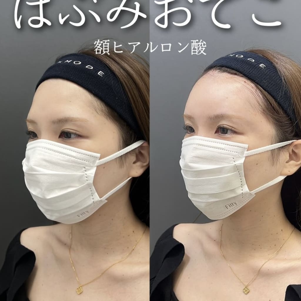 症例のビフォー画像
