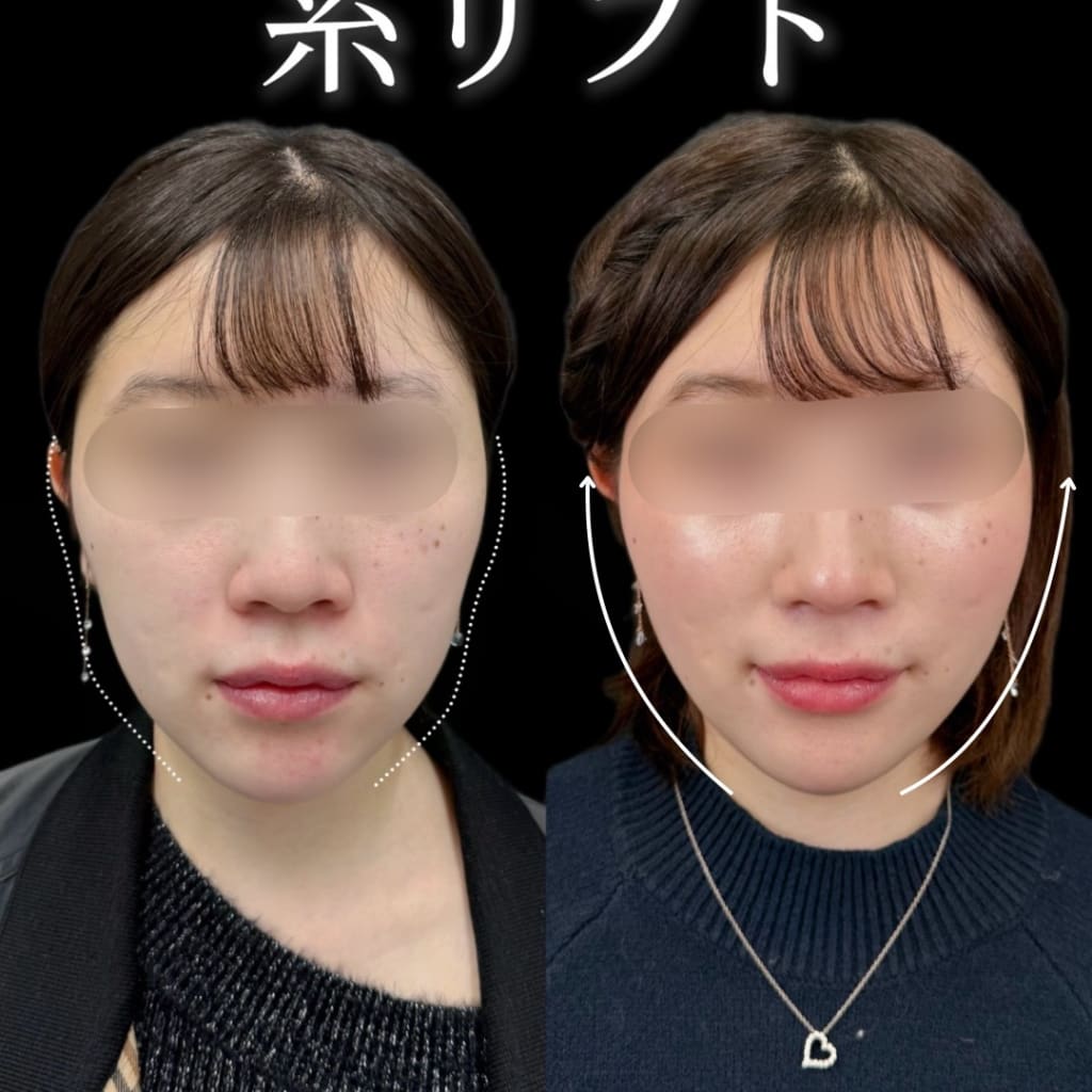 症例のビフォー画像