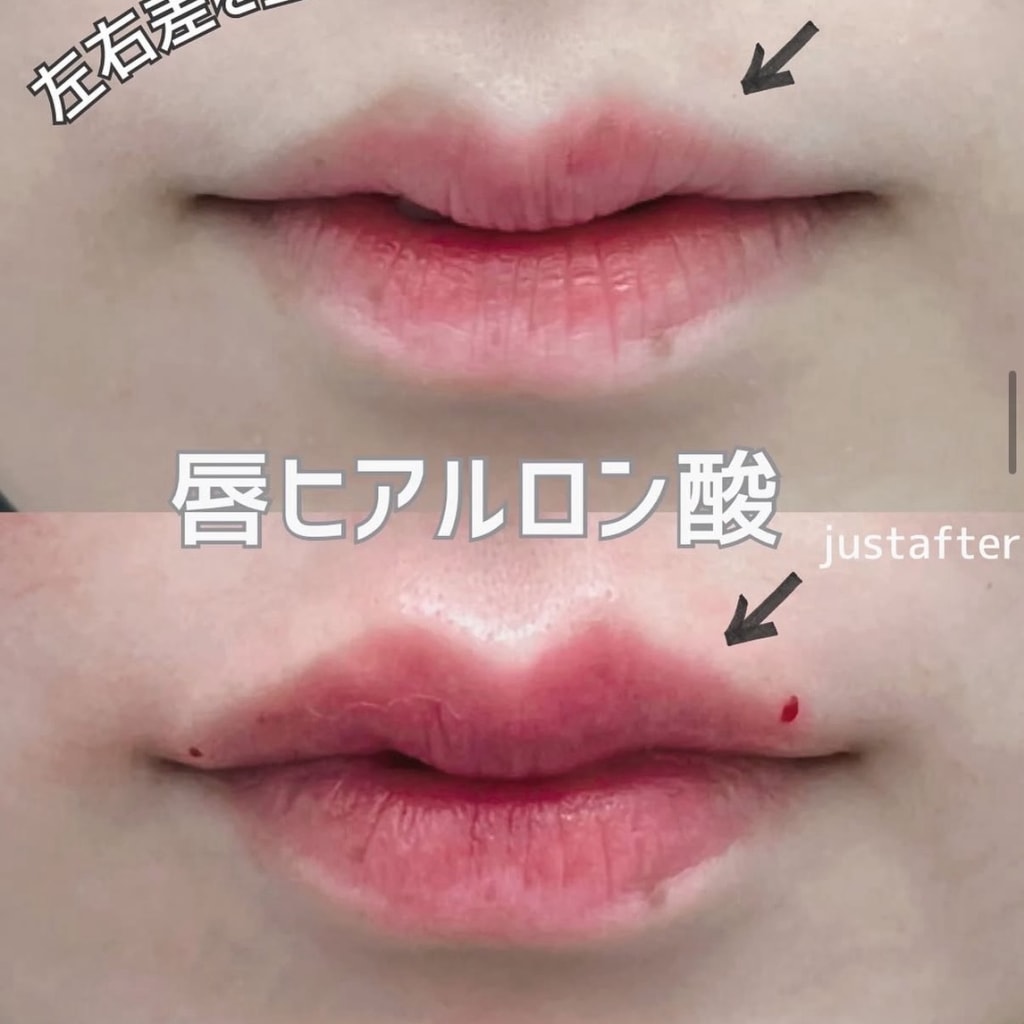 症例のビフォー画像