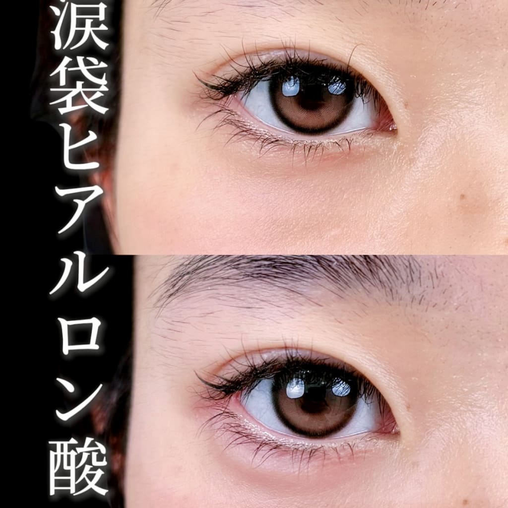 症例のビフォー画像