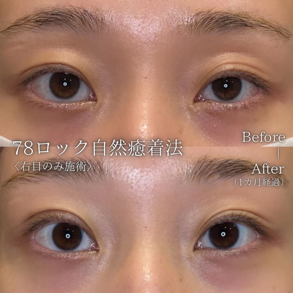 症例のビフォー画像