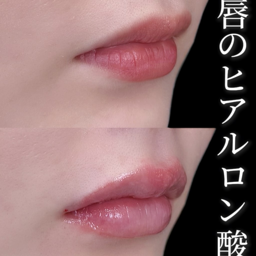 症例のビフォー画像