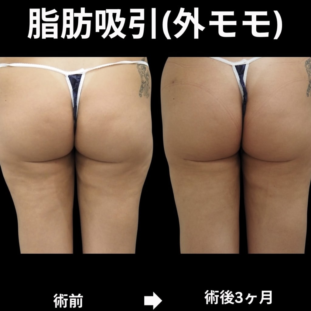 症例のビフォー画像