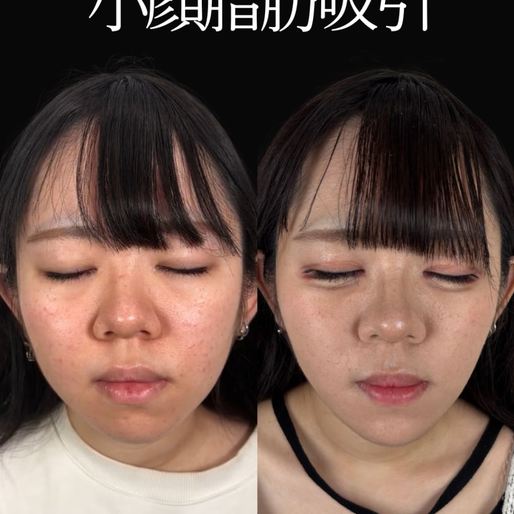 症例のビフォー画像