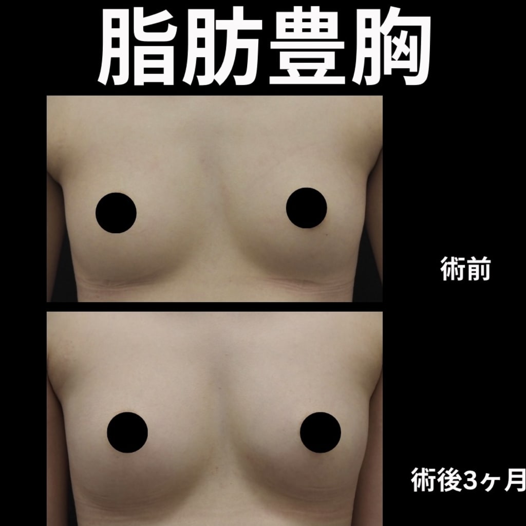 症例のビフォー画像
