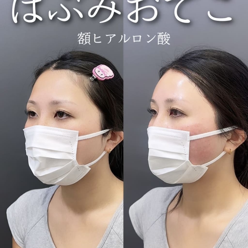 症例のビフォー画像