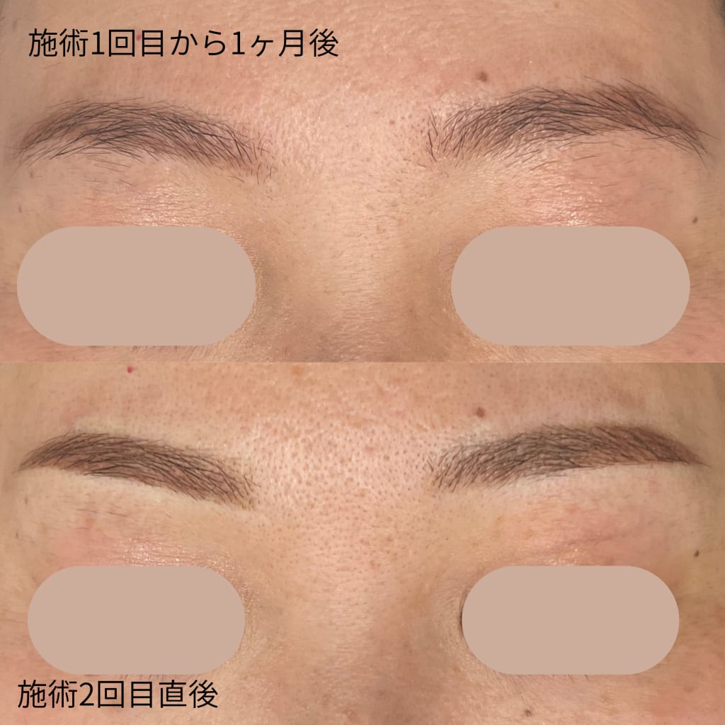 症例のビフォー画像