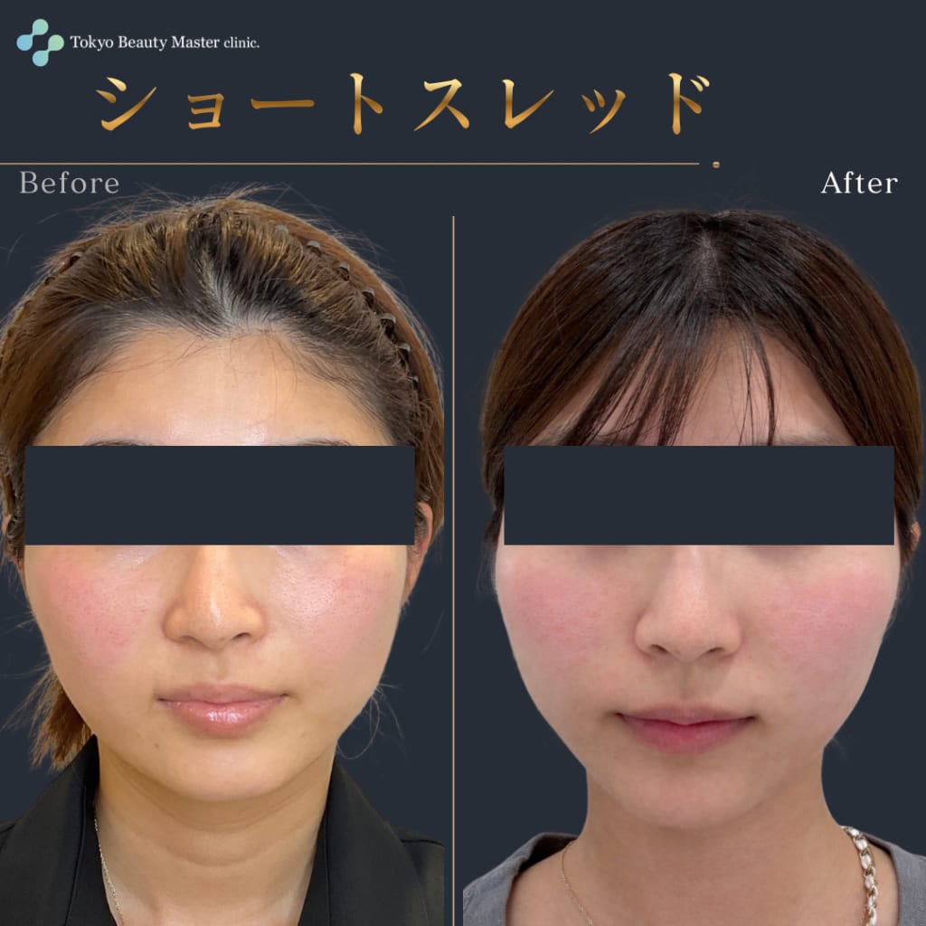 症例のビフォー画像