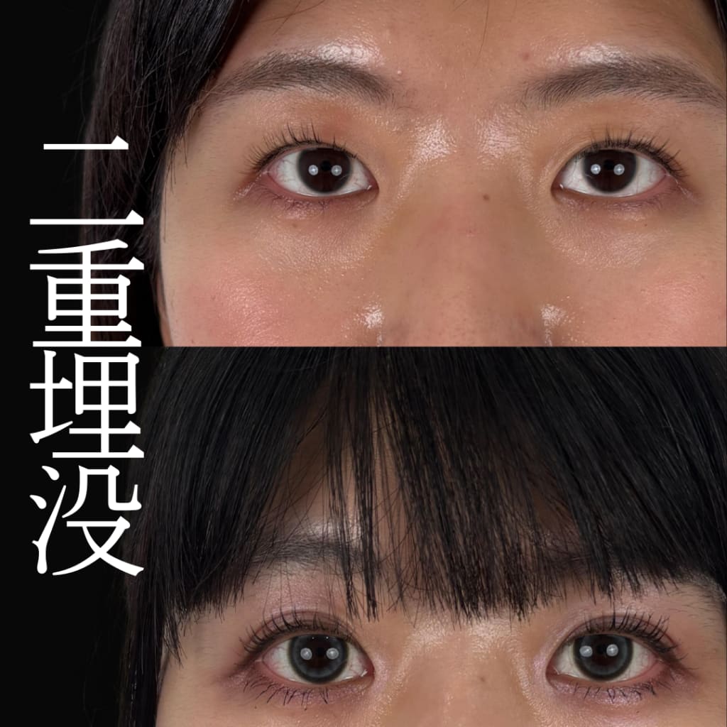症例のビフォー画像