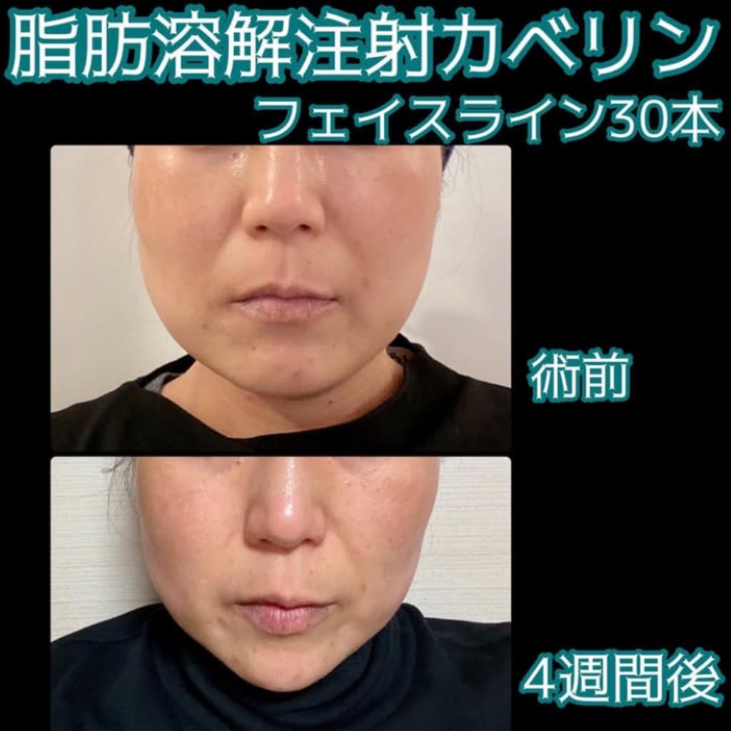 症例のビフォー画像