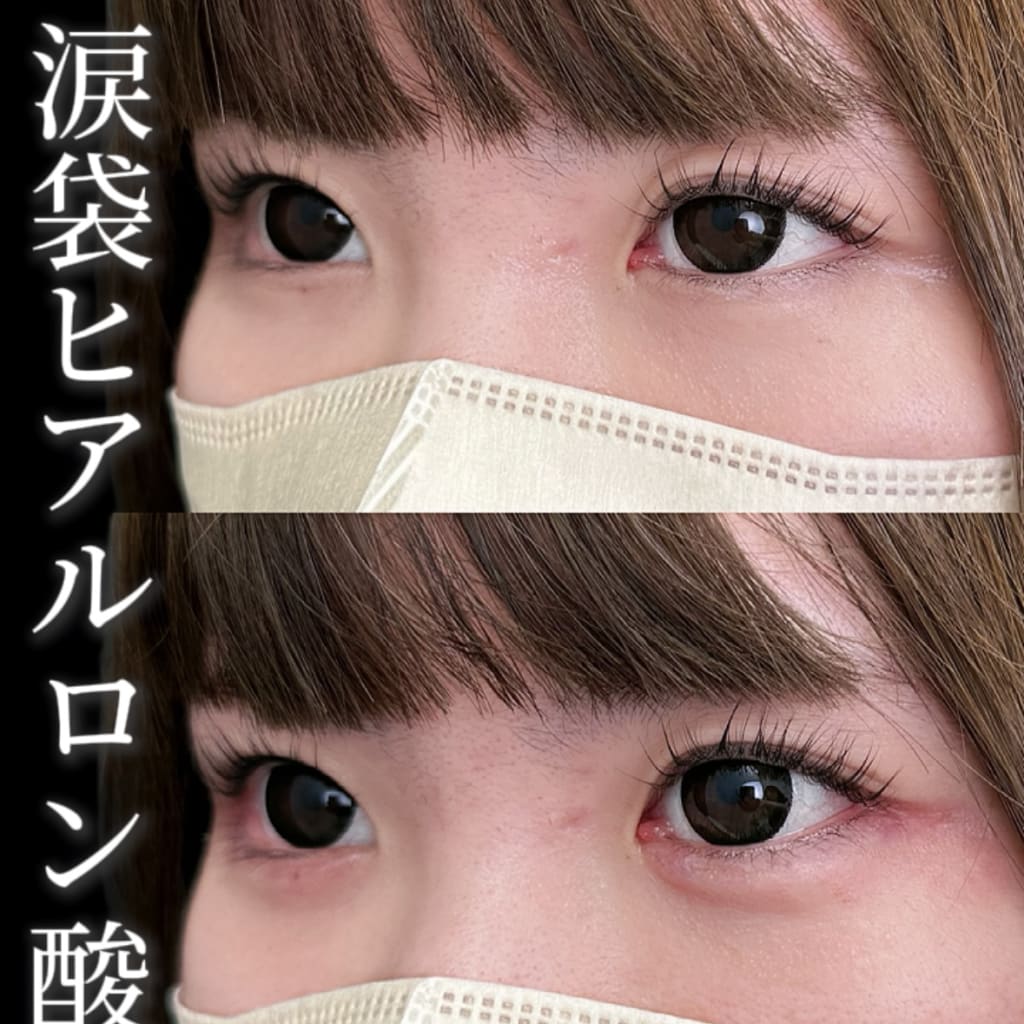 症例のビフォー画像