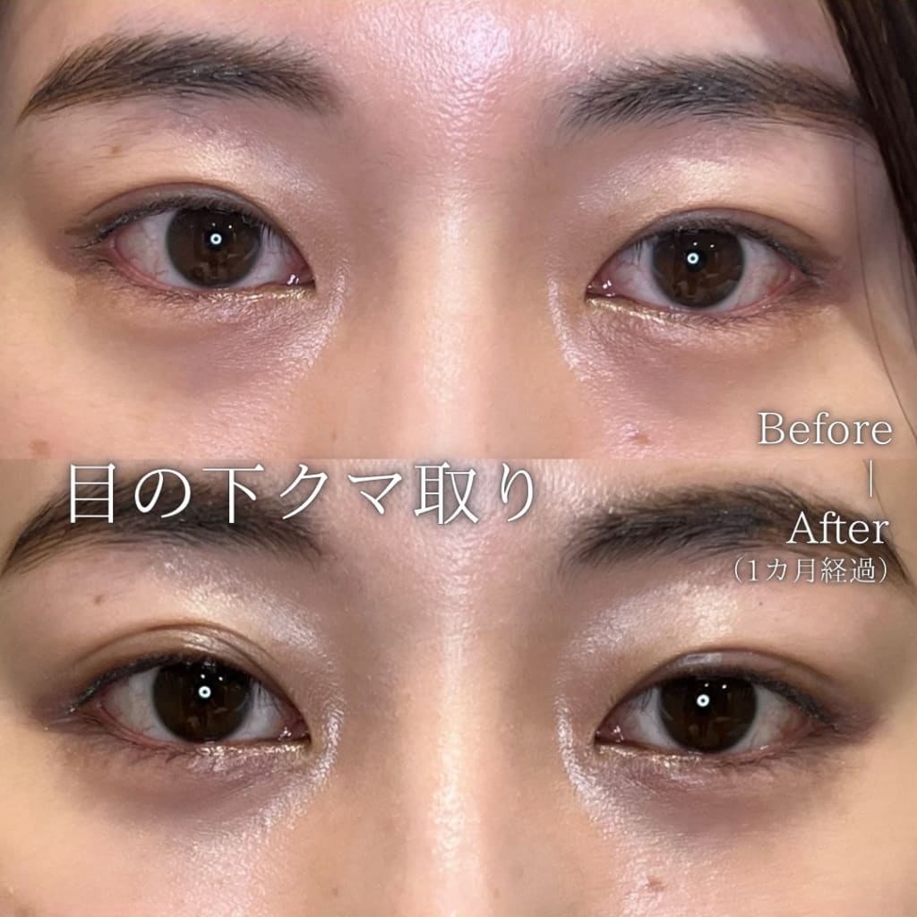 症例のビフォー画像