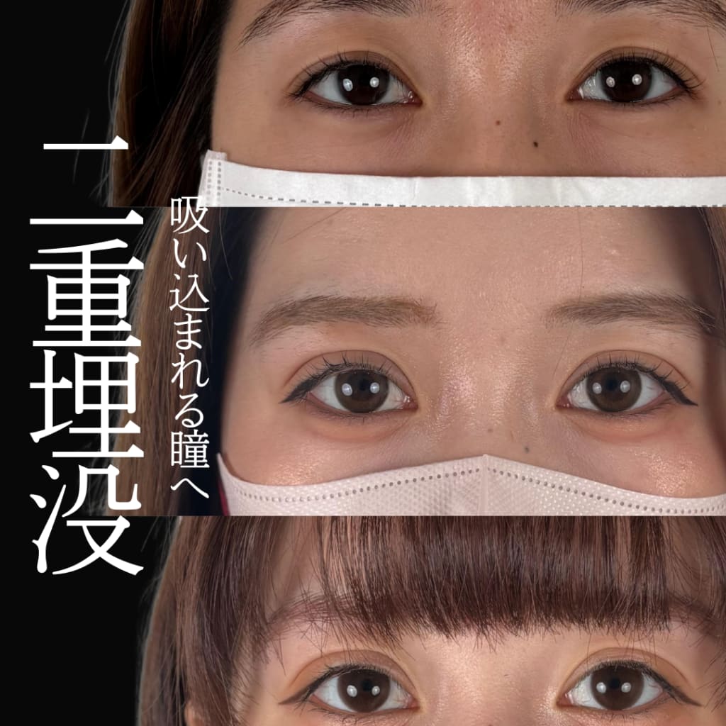 症例のビフォー画像