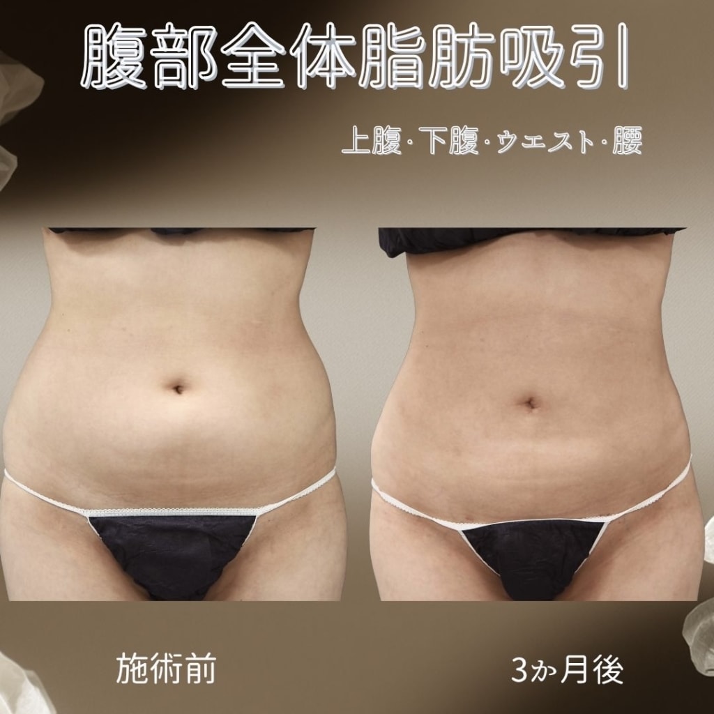 症例のビフォー画像