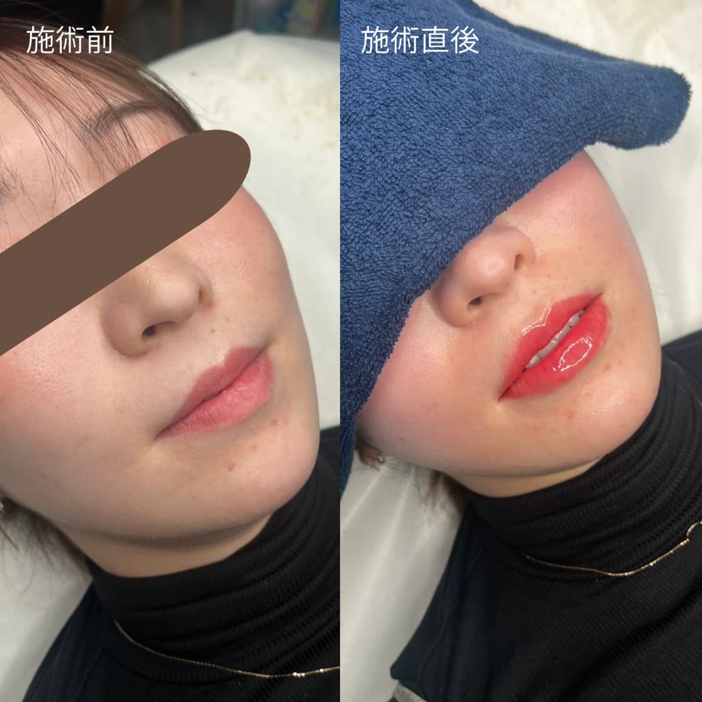 症例のビフォー画像